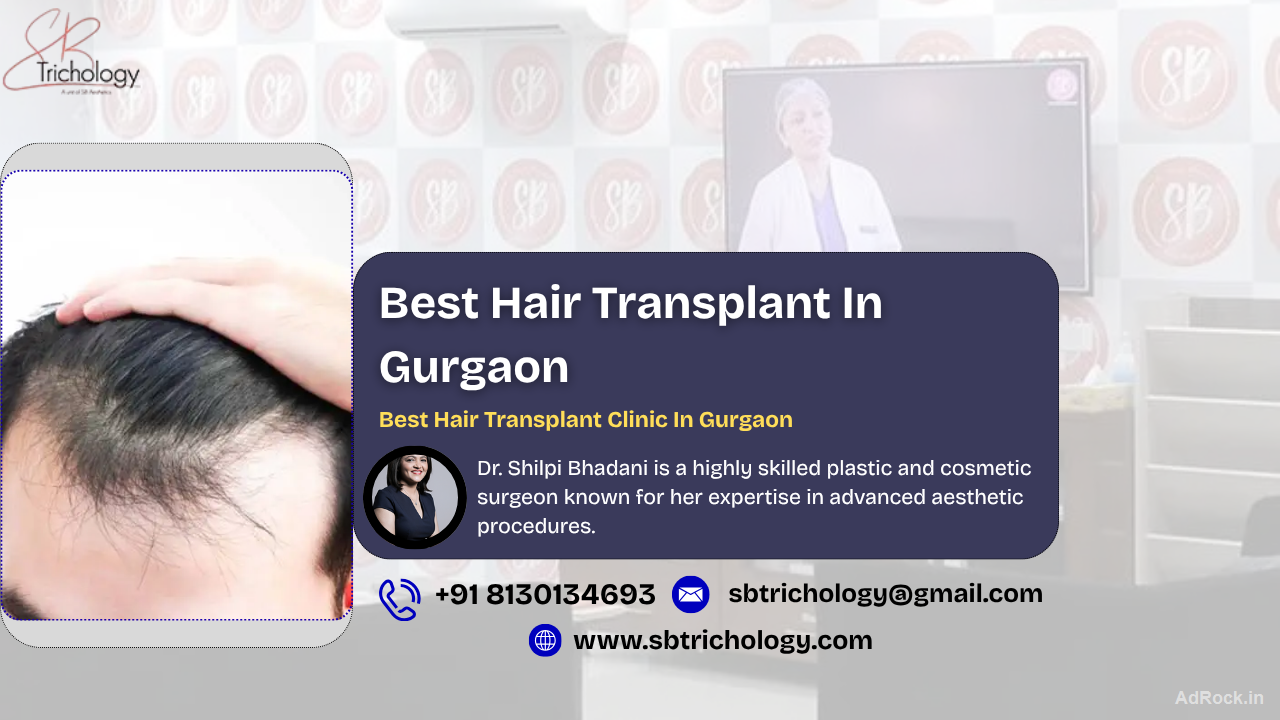 Trusted Hair Transplant Clinic in Gurgaon - SB Trichology