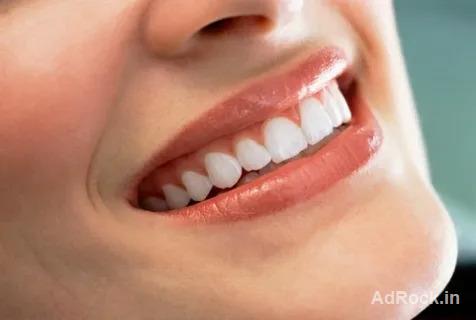 Perfect Your Smile – Smile Correction Cost in Coimbatore Perfect Your Smile – Smile Correction Cost in Coimbatore