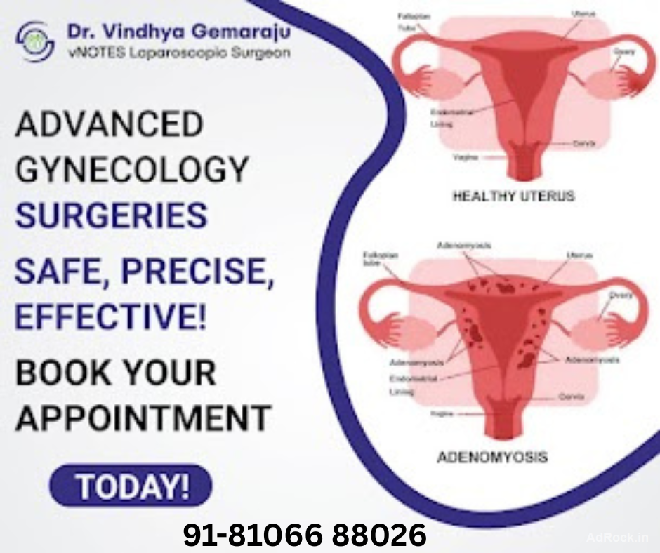 Best Gynecologist Hyderabad- Dr