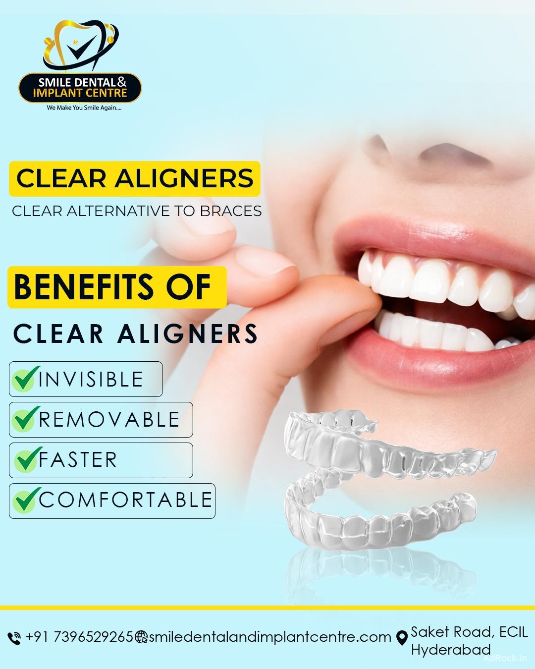 Best Dental Hospital in Secunderabad for Invisalign Treatment