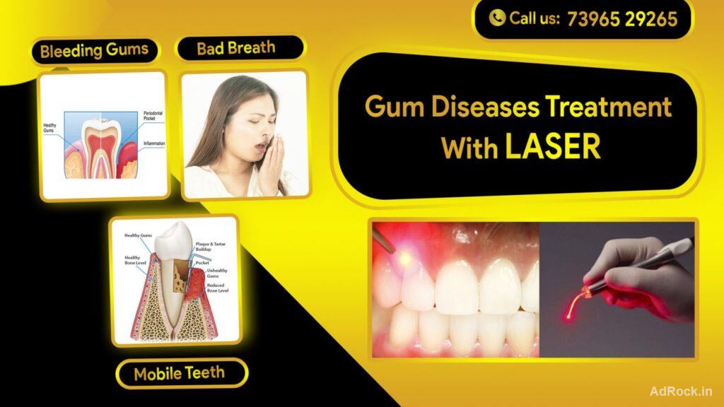 Effective Gum Disease Treatment for Healthy Teeth and Gums