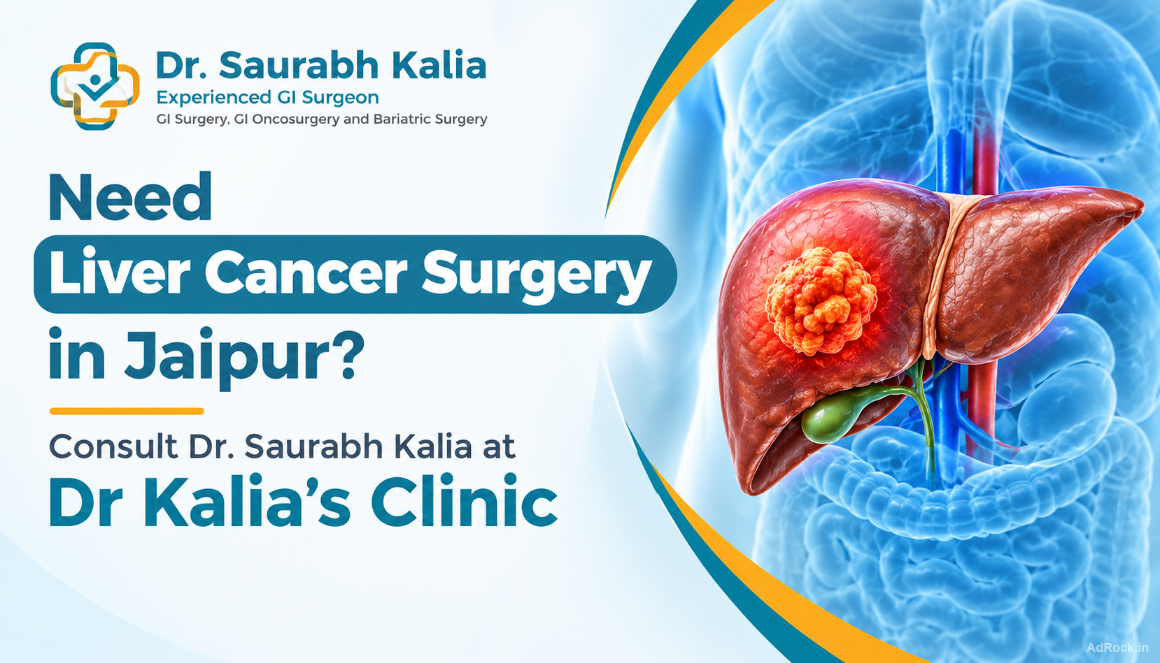 Need Liver Cancer Surgery in Jaipur? Dr. Saurabh Kalia