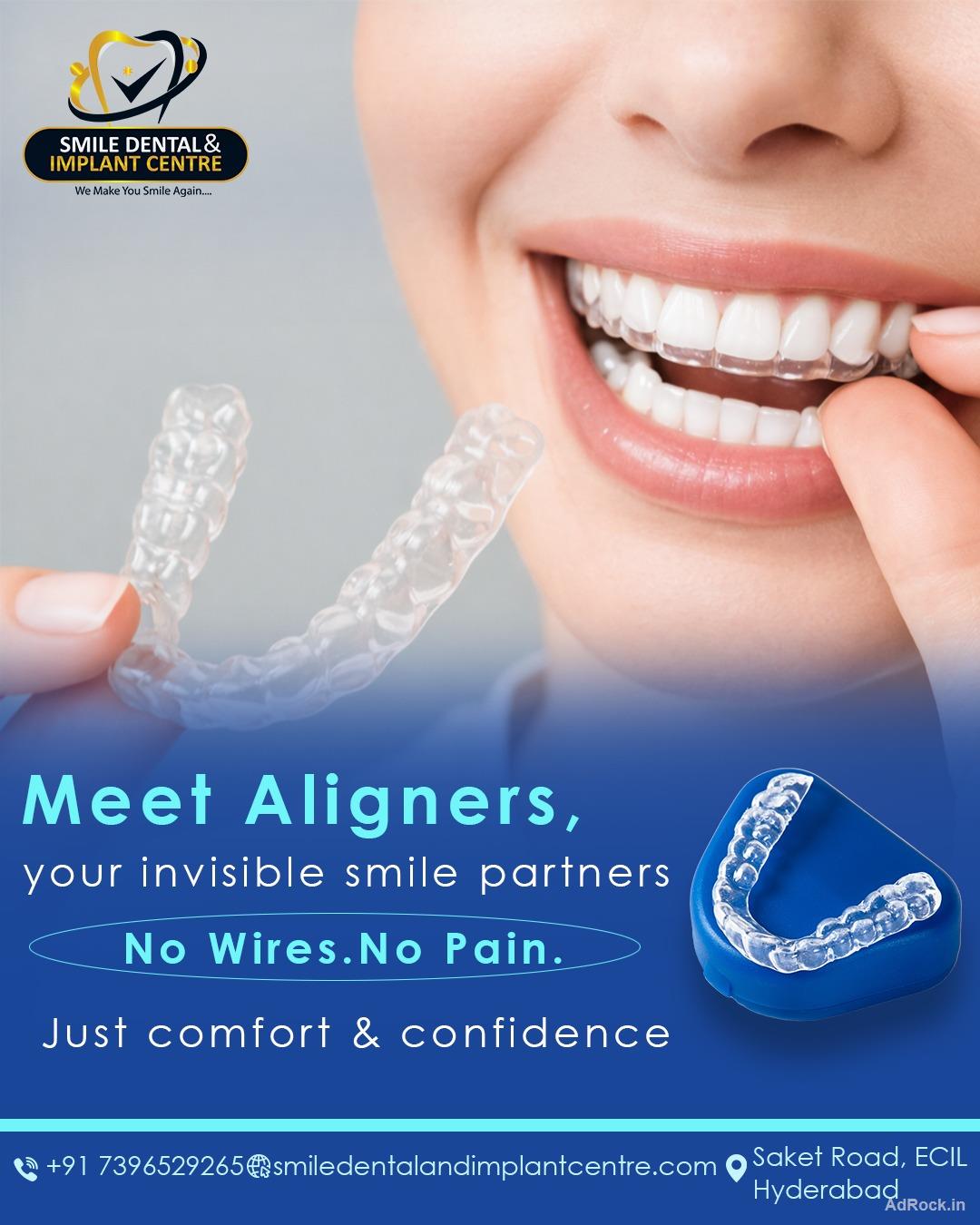 Invisible Braces in Sainikpuri – A Modern Way to Straighten Your Smile in Secunderabad.