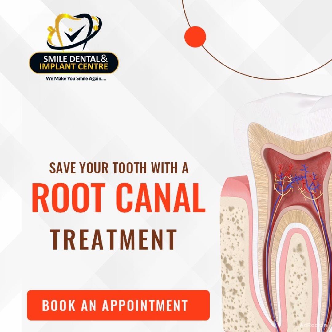 What is the minimum cost for root canal treatment in Sainikpuri?