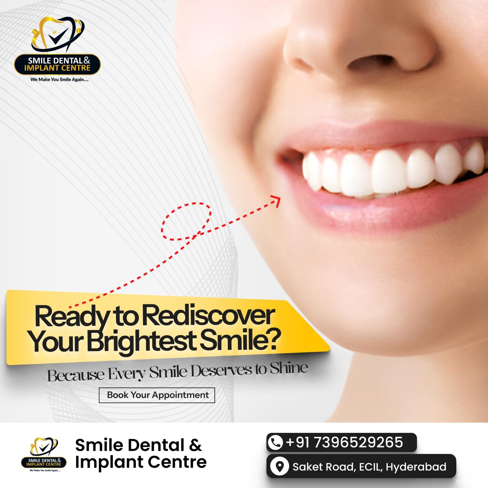 How much is the Price for Cleaning Teeth? | Dental Doctor near Me