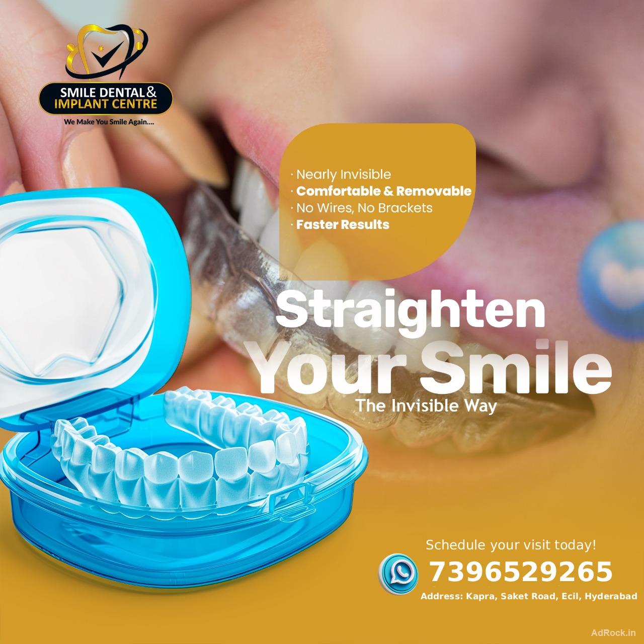 Invisalign in Secunderabad – Clear, Comfortable & Confident Smiles