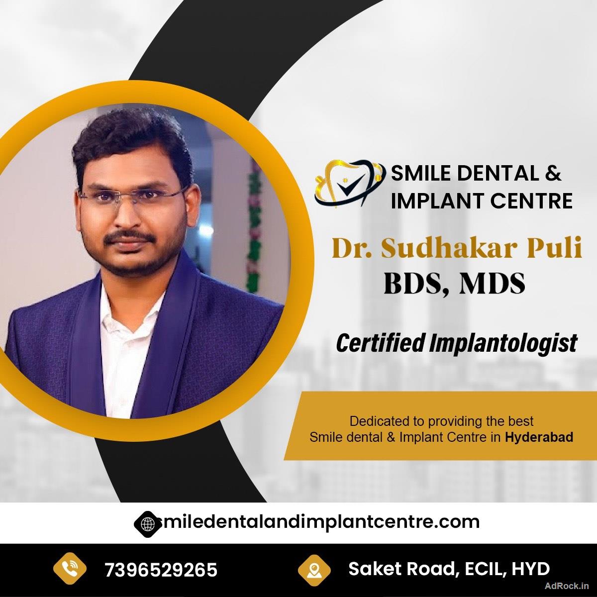Dr. Puli Sudhakar, MDS – Trusted Dental Specialist near you in Secunderabad.