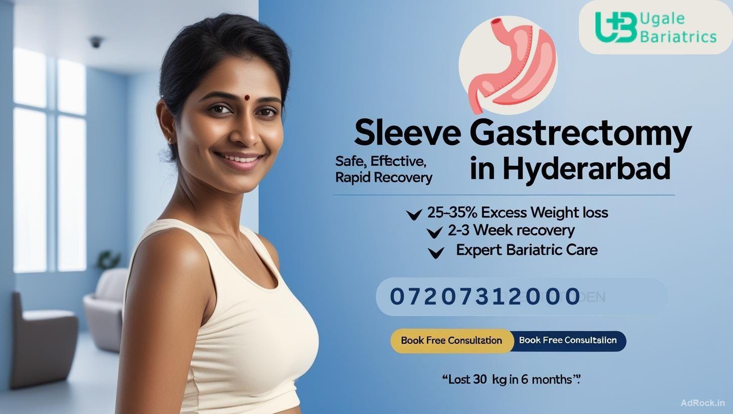 Sleeve Gastrectomy Operation in Hyderabad | Top Weight Loss Clinic