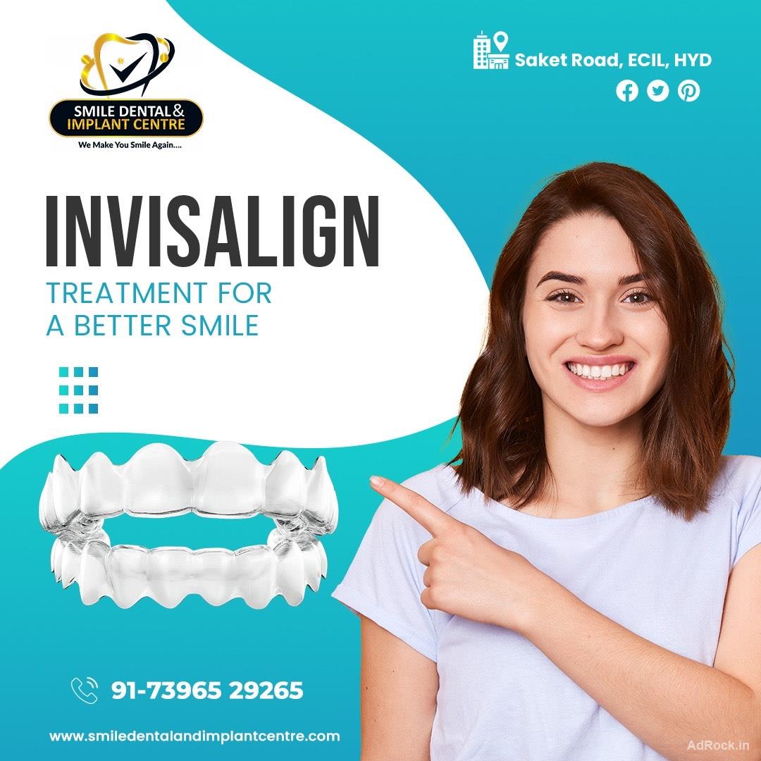 Top Rated Invisalign Near Me | Smile Dental Hyderabad Reviews
