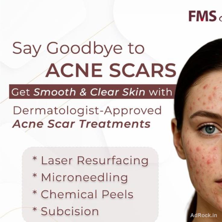 Best Acne Scar Treatment in Hyderabad - FMS Skin & Hair 