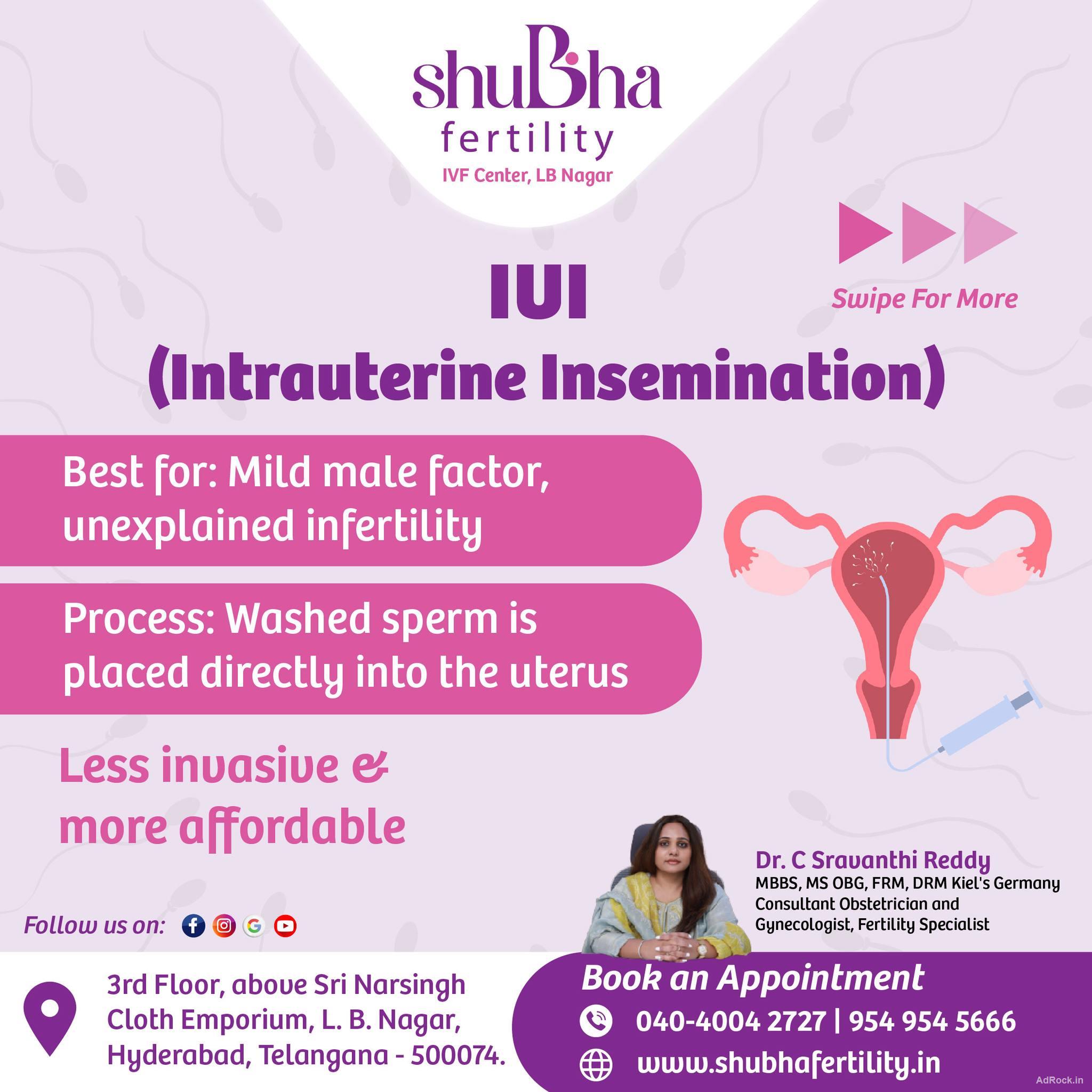 Top-Rated Fertility Center in Hyderabad | Best IVF Centre Top-Rated Fertility Center in Hyderabad | Best IVF Centre