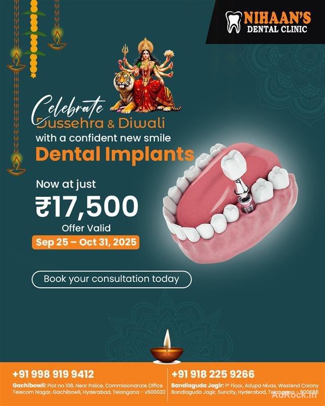 D&D offer on dental implants | Nihaans Dental Clinic D&D offer on dental implants | Nihaans Dental Clinic