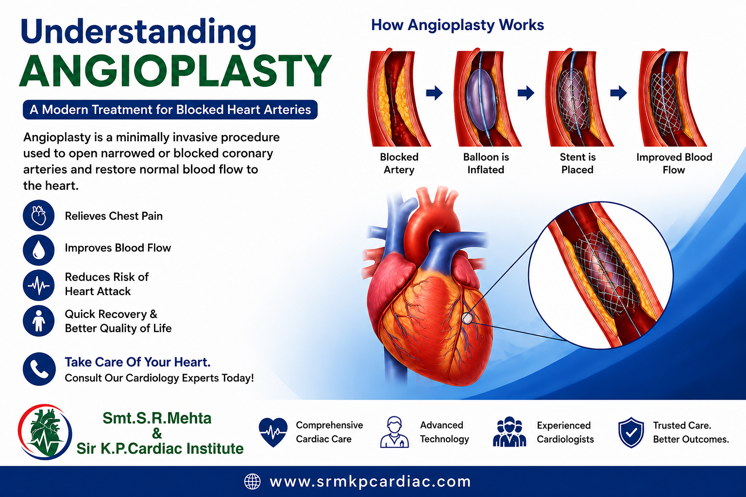 Angioplasty Services